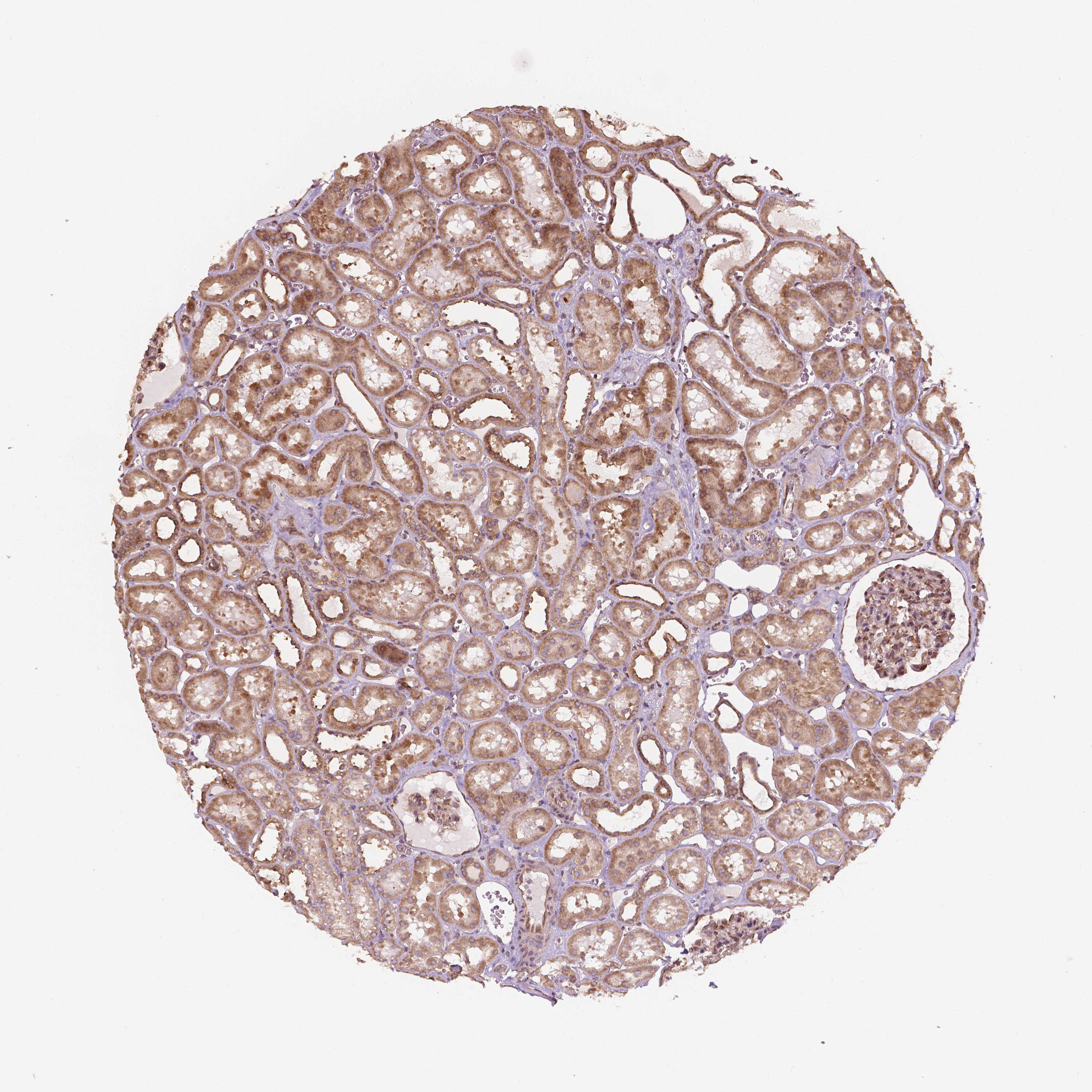Tissue expression of G3BP1 Staining in kidney The Human Protein Atlas