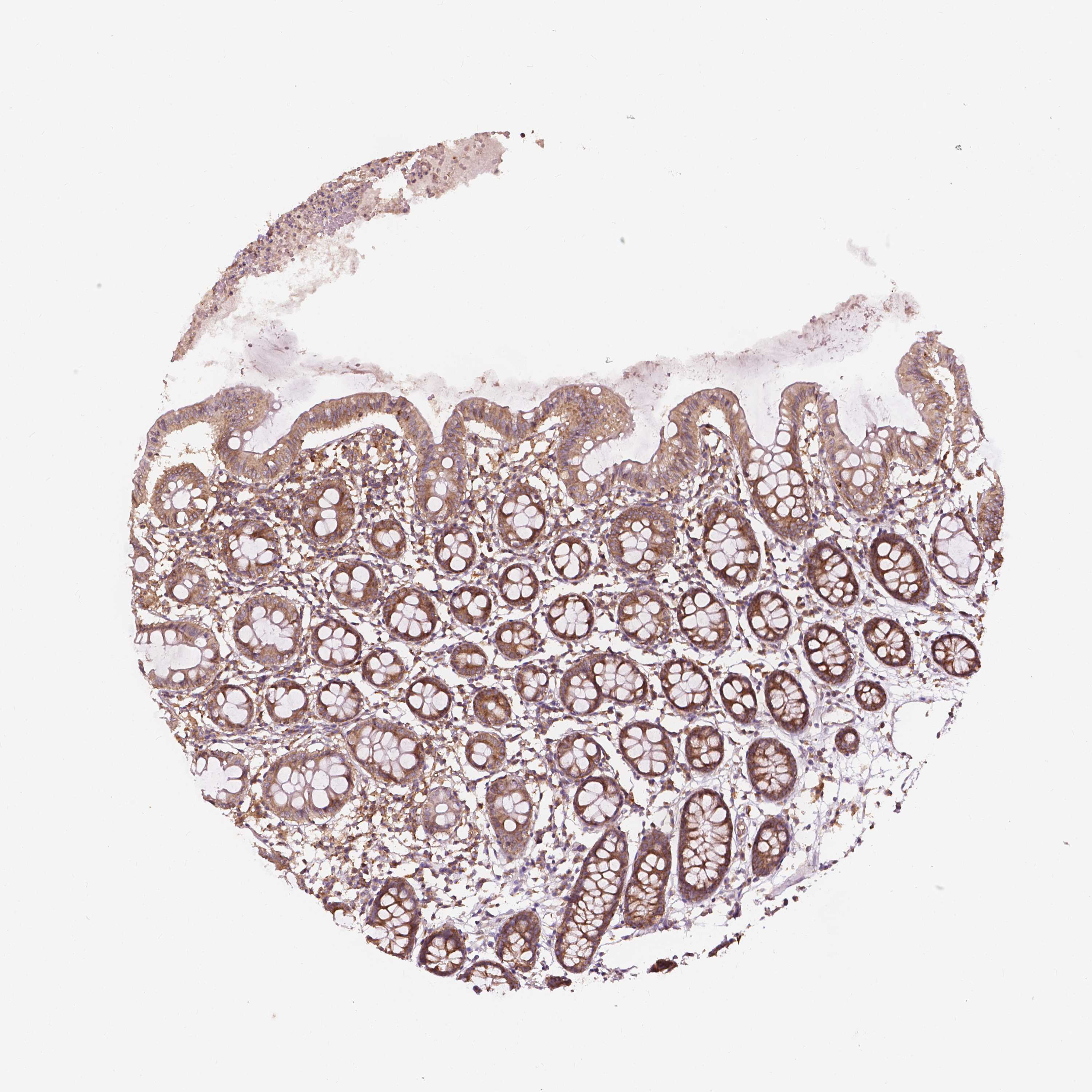 Tissue expression of G3BP1 Staining in colon The Human Protein Atlas