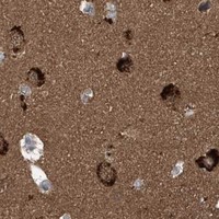 HPA IHC Cerebral cortex — PFN2