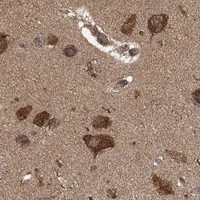 HPA IHC Cerebral cortex — PCBP1