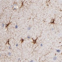HPA IHC Cerebral cortex — MID1