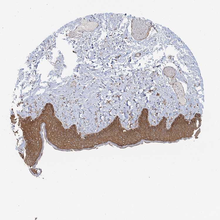 Tissue expression of LRRK2 Staining in skin The Human Protein Atlas