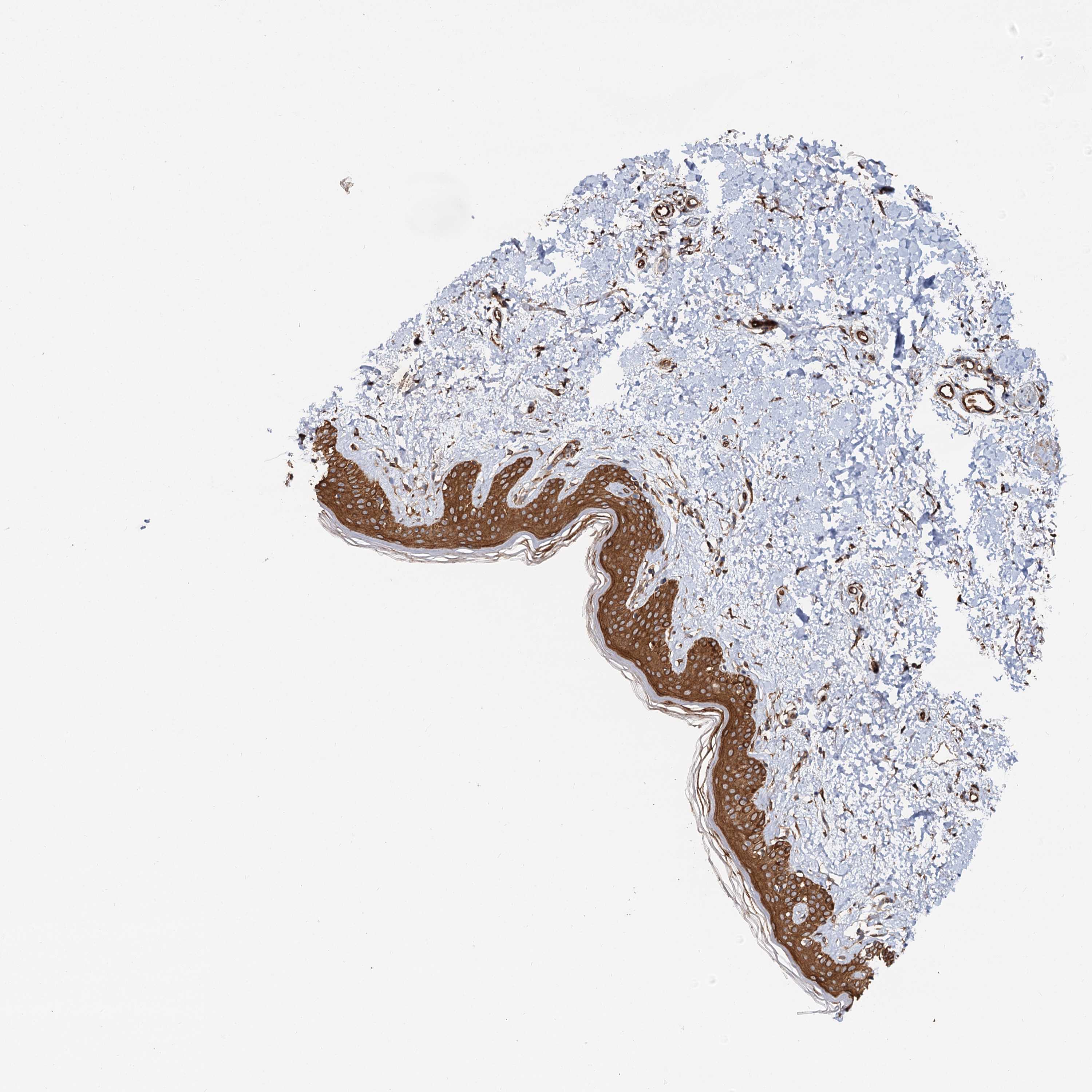 Tissue expression of LRRK2 Staining in skin The Human Protein Atlas