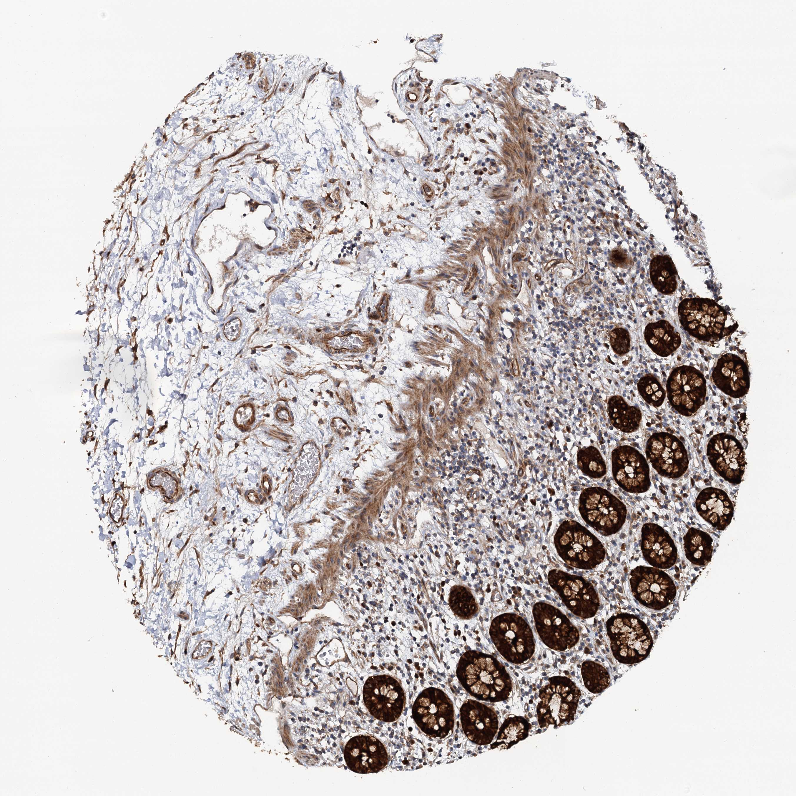 Tissue expression of LRRK2 Staining in colon The Human Protein Atlas