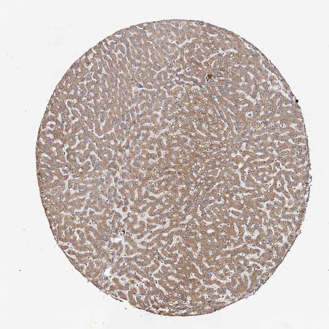 Tissue expression of LRRK2 Staining in liver The Human Protein Atlas