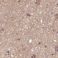 HPA IHC Cerebral cortex — MAP1LC3B