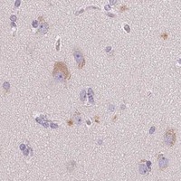 HPA IHC Cerebral cortex — DHCR24