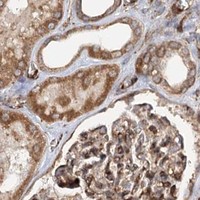 HPA IHC Kidney — MKNK1