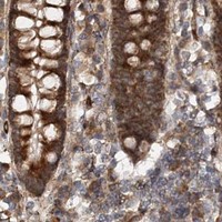 HPA IHC Colon — MKNK1