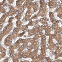HPA IHC Liver — MKNK1