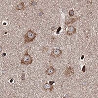 HPA IHC Cerebral cortex — MKNK1