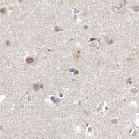 HPA IHC Cerebral cortex — SUMO2