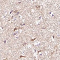 HPA IHC Cerebral cortex — IQGAP2