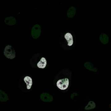 HPA037475: HeLa BAC 5197