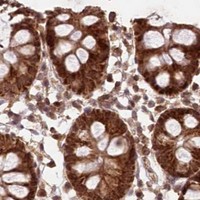 HPA IHC Colon — MICU1