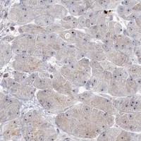HPA IHC Pancreas — SH3BP4