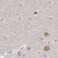 HPA IHC Cerebral cortex — SH3BP4