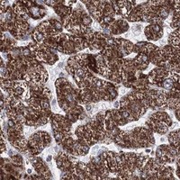 HPA IHC Liver — HADHB