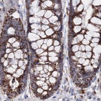 HPA IHC Colon — HADHB