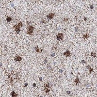 HPA IHC Cerebral cortex — HADHB
