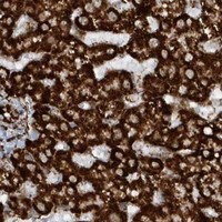 HPA IHC Liver — CRY2