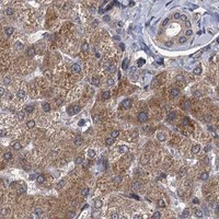 HPA IHC Liver — INPPL1