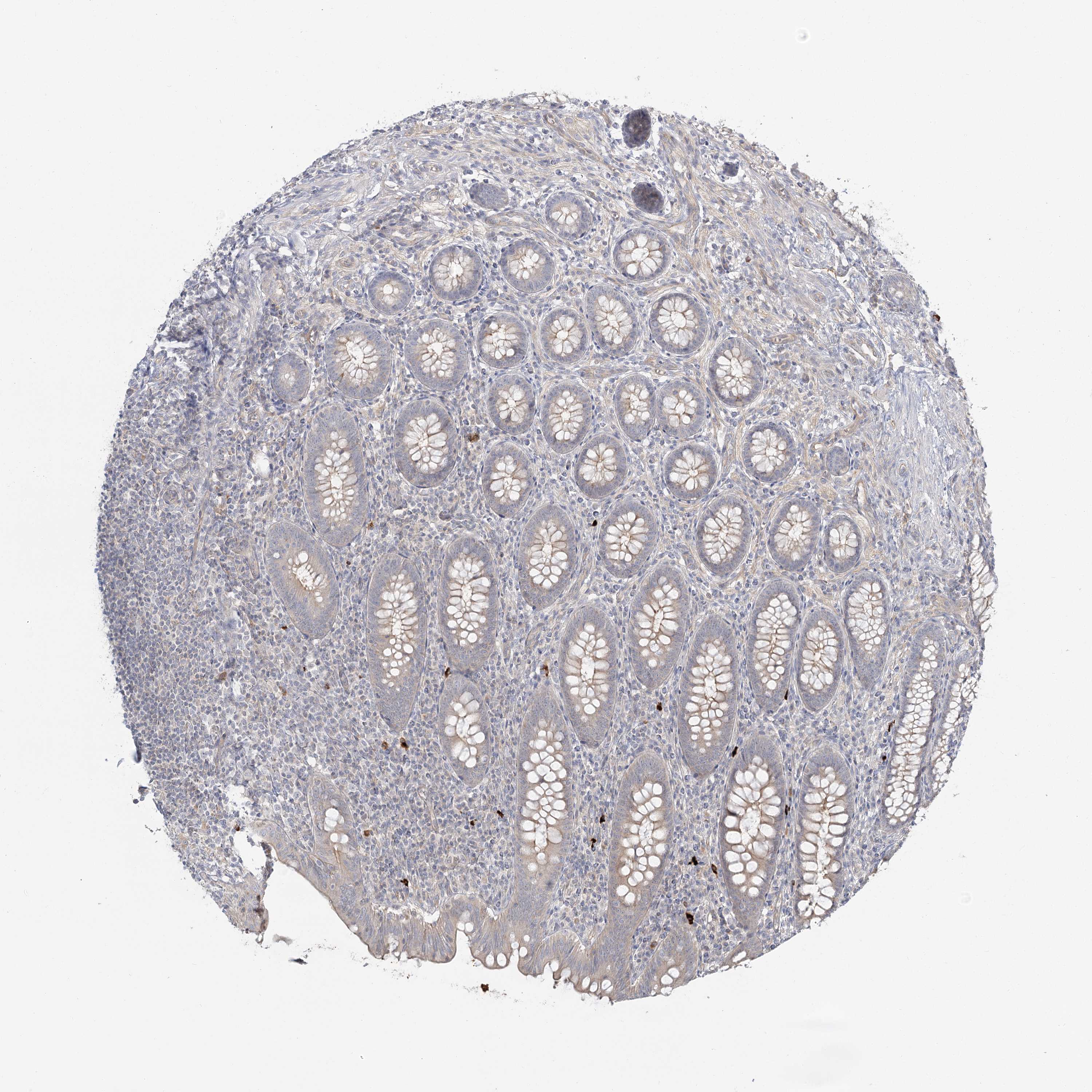 Tissue expression of GUCY2C Staining in appendix The Human Protein