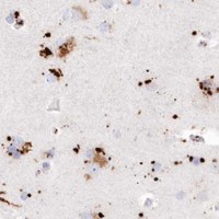 HPA IHC Cerebral cortex — TPP1