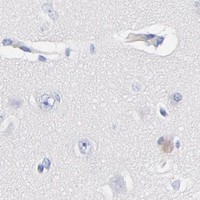 HPA IHC Cerebral cortex — CPS1