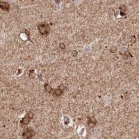 HPA IHC Cerebral cortex — WAPL