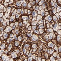 HPA IHC Liver — CCR3