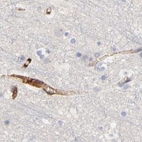 HPA IHC Cerebral cortex — CCR3