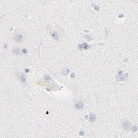 HPA IHC Cerebral cortex — CCR7