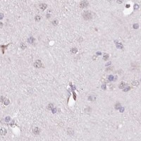 HPA IHC Cerebral cortex — WWC1