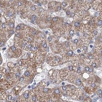 HPA IHC Liver — LPIN1