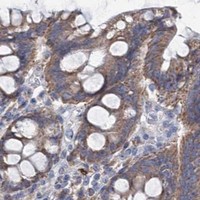 HPA IHC Colon — LPIN1