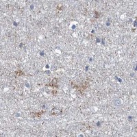 HPA IHC Cerebral cortex — LPIN1