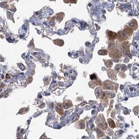 HPA IHC Lung — MTRR