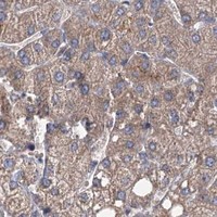 HPA IHC Liver — MTRR