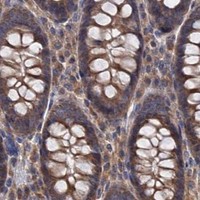 HPA IHC Colon — MTRR