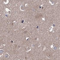 HPA IHC Cerebral cortex — MTRR
