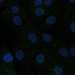 HPA038127: hTERT-RPE1 (serum starved)
