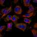 CAB003815: U-251MG