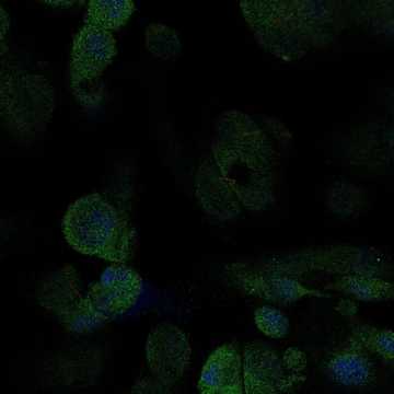 HPA038218: RPTEC/TERT1