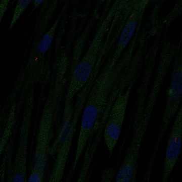 HPA038218: ASC52telo