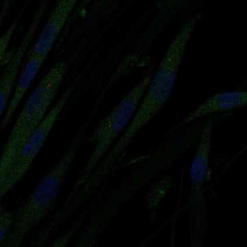 HPA038218: ASC52telo