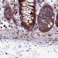 HPA IHC Colon — TCOF1