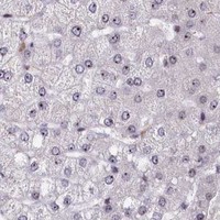 HPA IHC Liver — TCOF1