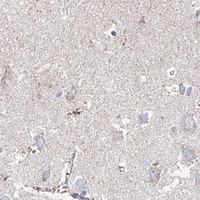 HPA IHC Cerebral cortex — MCCC2
