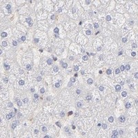 HPA IHC Liver — MAP2K2